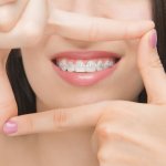 Les critères de choix d'une mutuelle pour orthodontie !